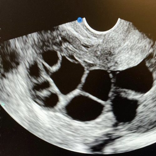 Building Your Family Through ED-FAED